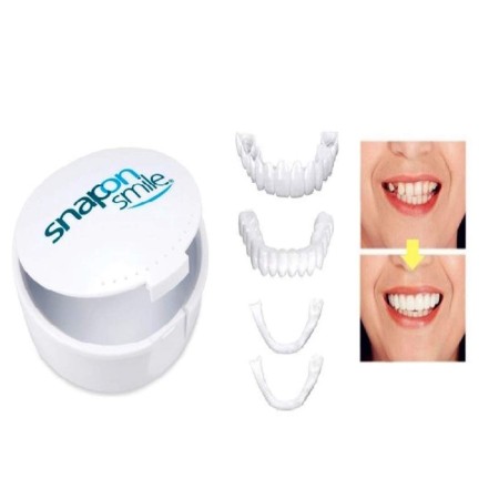 Snap On Smile(মুখের হাসি ও দাঁতের সৌন্দর্য ধরে রাখার প্রোডাক্ট